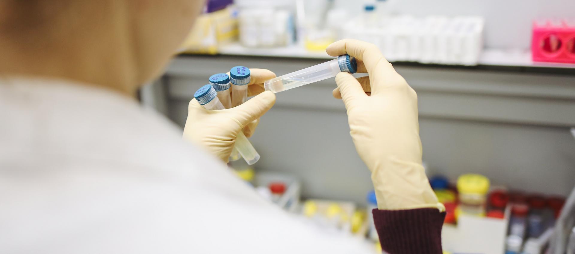 person holding test tubes 3735747